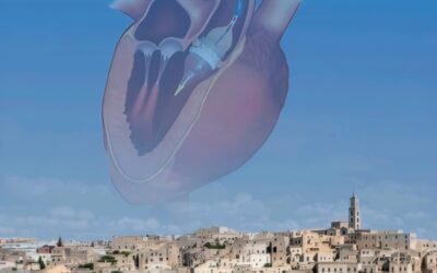 Cardiologia interventistica, a Matera due giorni con i massimi esperti: focus su innovazione e cure avanzate